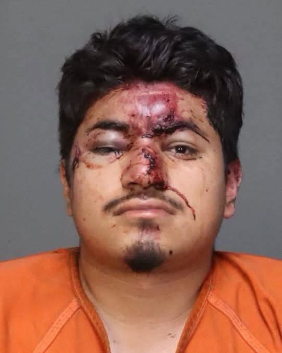 Matthew D. Cruz de 36 años, fue detenido por el Departamento de Policía de Beverly Hills y es...