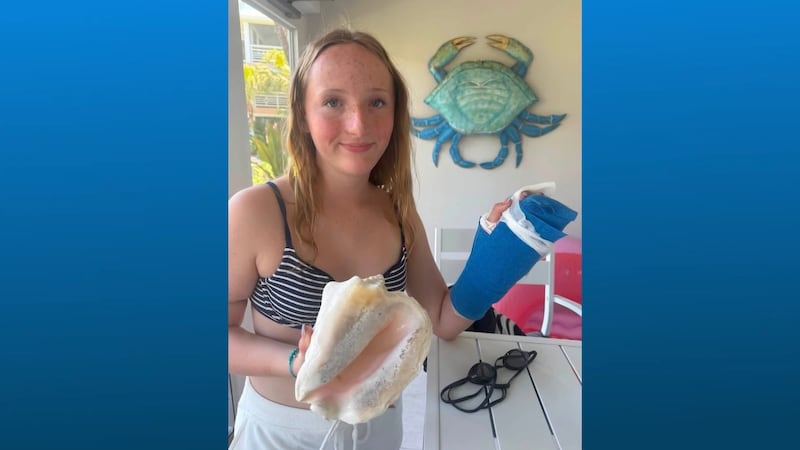 Claire Macdonel, de 13 años, fue mordida por una barracuda mientras hacía el pino en aguas...