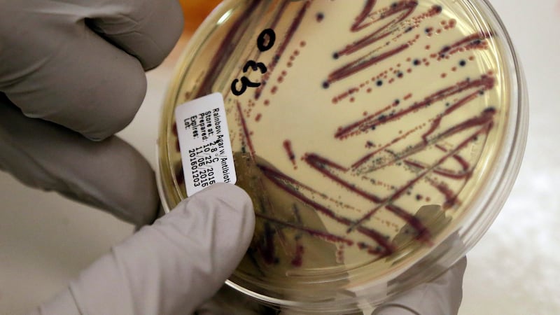 ARCHIVO - Un microbiólogo señala un cultivo aislado de E. coli en una placa de agar en el...